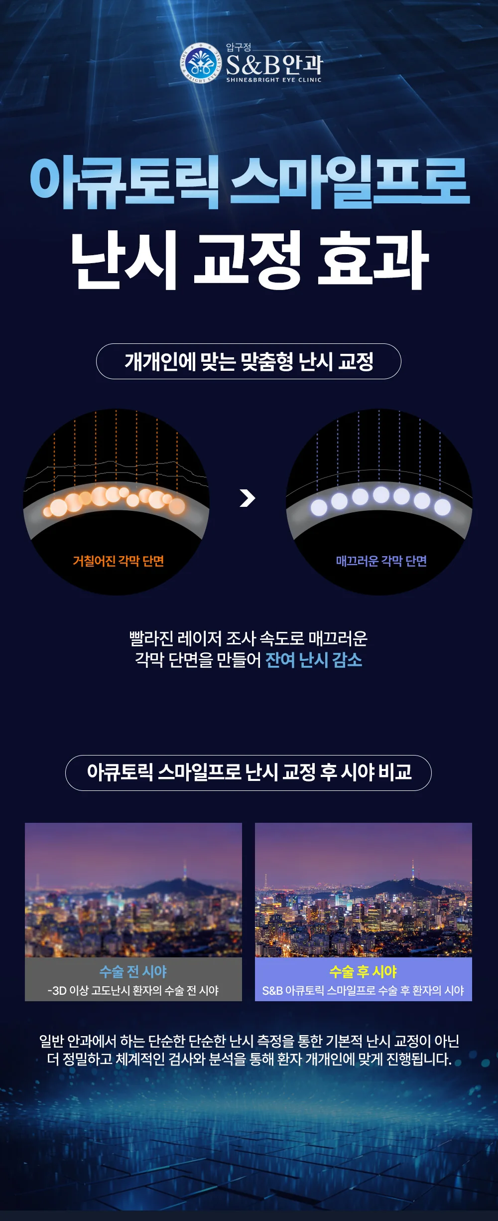 아큐토릭 스마일프로 난시 교정 효과 안내 이미지